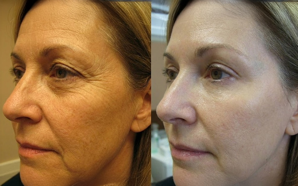 Controversial Discovery: The Real Reason Your Skin Ages (It's Not What You Think)